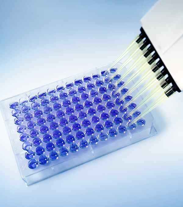 https://euro-linkpharma.co.uk/wp-content/uploads/2020/04/service_7-3.jpg